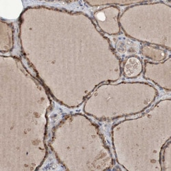 Invitrogen PHYH Polyclonal Antibody 100 &mu;L; Unconjugated:Antibodies,