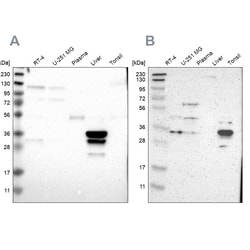Invitrogen PHYH Polyclonal Antibody 100 &mu;L; Unconjugated:Antibodies,
