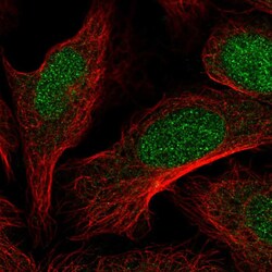 Invitrogen Dot1L Polyclonal Antibody 100 &mu;L; Unconjugated:Antibodies,