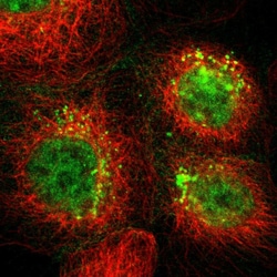 Invitrogen TSPAN1 Polyclonal Antibody 100 &mu;L; Unconjugated:Antibodies,