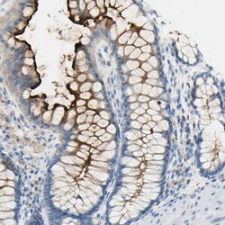 Invitrogen TSPAN1 Polyclonal Antibody 100 &mu;L; Unconjugated:Antibodies,