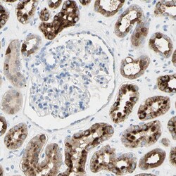 Invitrogen TSPAN1 Polyclonal Antibody 100 &mu;L; Unconjugated:Antibodies,