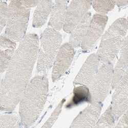 Invitrogen TSPAN1 Polyclonal Antibody 100 &mu;L; Unconjugated:Antibodies,