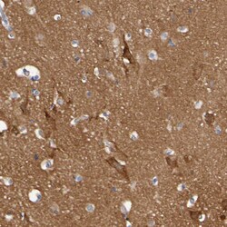 Invitrogen Synaptojanin 1 Polyclonal Antibody 100 &mu;L; Unconjugated:Antibodies,