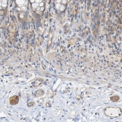 Invitrogen Synaptojanin 1 Polyclonal Antibody 100 &mu;L; Unconjugated:Antibodies,