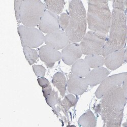 Invitrogen Synaptojanin 1 Polyclonal Antibody 100 &mu;L; Unconjugated:Antibodies,