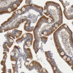Invitrogen GCS1 Polyclonal Antibody 100 &mu;L; Unconjugated:Antibodies,