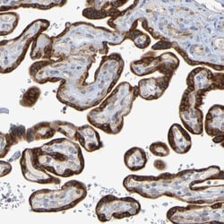Invitrogen GCS1 Polyclonal Antibody 100 &mu;L; Unconjugated:Antibodies,