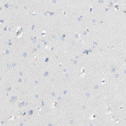 Invitrogen ACADL Polyclonal Antibody 100 &mu;L; Unconjugated:Antikroppar