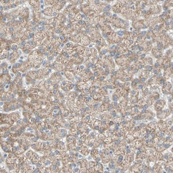 Invitrogen ACADL Polyclonal Antibody 100 &mu;L; Unconjugated:Antikroppar