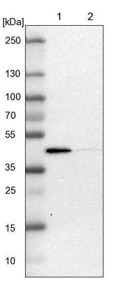 Invitrogen ACADL Polyclonal Antibody 100 &mu;L; Unconjugated:Antikroppar