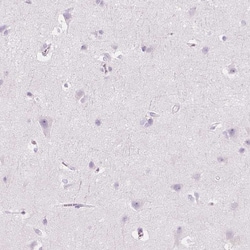 Invitrogen CES1 Polyclonal Antibody 100 &mu;L; Unconjugated:Antibodies,