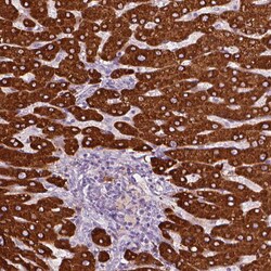 Invitrogen CES1 Polyclonal Antibody 100 &mu;L; Unconjugated:Antibodies,