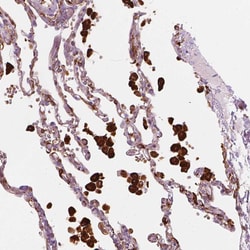 Invitrogen CES1 Polyclonal Antibody 100 &mu;L; Unconjugated:Antibodies,