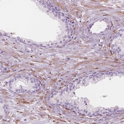 Invitrogen CES1 Polyclonal Antibody 100 &mu;L; Unconjugated:Antibodies,