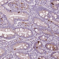 Invitrogen CES1 Polyclonal Antibody 100 &mu;L; Unconjugated:Antibodies,
