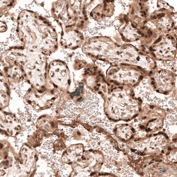 Invitrogen PARP14 Polyclonal Antibody 100 &mu;L; Unconjugated:Antibodies,
