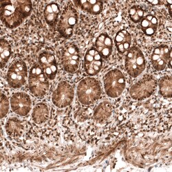 Invitrogen PARP14 Polyclonal Antibody 100 &mu;L; Unconjugated:Antibodies,