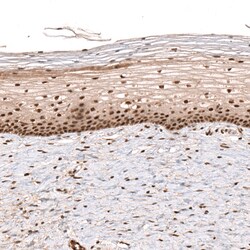 Invitrogen PARP14 Polyclonal Antibody 100 &mu;L; Unconjugated:Antibodies,