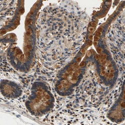 Invitrogen TNIK Polyclonal Antibody 100 &mu;L; Unconjugated:Antibodies,