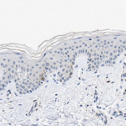 Invitrogen TNIK Polyclonal Antibody 100 &mu;L; Unconjugated:Antibodies,