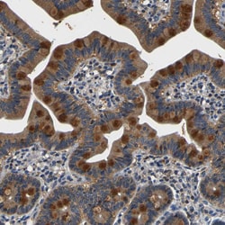 Invitrogen TNIK Polyclonal Antibody 100 &mu;L; Unconjugated:Antibodies,