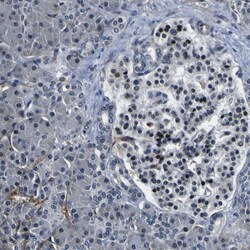 Invitrogen Periostin Polyclonal Antibody 100 &mu;L; Unconjugated:Antibodies,