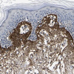 Invitrogen Periostin Polyclonal Antibody 100 &mu;L; Unconjugated:Antibodies,