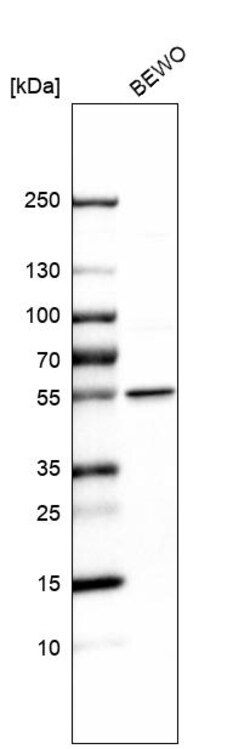 Invitrogen LPCAT1 Polyclonal Antibody 100 &mu;L | Buy Online | Invitrogen&trade; | Fisher Scientific