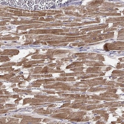 Invitrogen ENDOGL1 Polyclonal Antibody 100 &mu;L; Unconjugated:Antibodies,