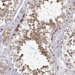 Invitrogen ENDOGL1 Polyclonal Antibody 100 &mu;L; Unconjugated:Antibodies,