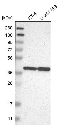 Invitrogen ENDOGL1 Polyclonal Antibody 100 &mu;L | Buy Online | Invitrogen&trade; | Fisher Scientific