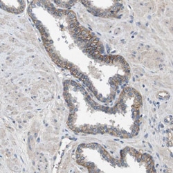 Invitrogen CD155 Polyclonal Antibody 100 &mu;L | Buy Online | Invitrogen&trade; | Fisher Scientific