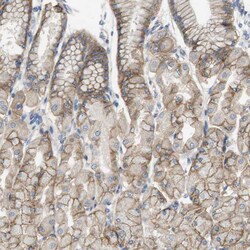 Invitrogen CD155 Polyclonal Antibody 100 &mu;L | Buy Online | Invitrogen&trade; | Fisher Scientific