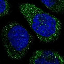 Invitrogen THSD1 Polyclonal Antibody 100 &mu;L; Unconjugated:Antibodies,