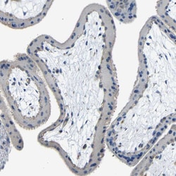 Invitrogen THSD1 Polyclonal Antibody 100 &mu;L; Unconjugated:Antibodies,