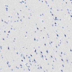 Invitrogen Desmocollin 2 Polyclonal Antibody 100 &mu;L; Unconjugated:Antibodies,