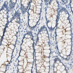 Invitrogen Desmocollin 2 Polyclonal Antibody 100 &mu;L; Unconjugated:Antibodies,