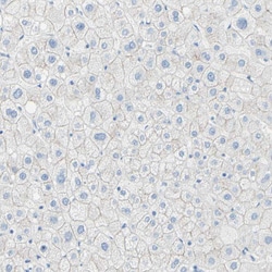 Invitrogen Desmocollin 2 Polyclonal Antibody 100 &mu;L; Unconjugated:Antibodies,