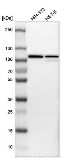Invitrogen VCP Polyclonal Antibody 100 &mu;L; Unconjugated:Antibodies,