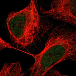 Invitrogen Calcineurin A Polyclonal Antibody 100 &mu;L; Unconjugated:Antibodies,
