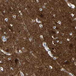 Invitrogen Calcineurin A Polyclonal Antibody 100 &mu;L; Unconjugated:Antibodies,