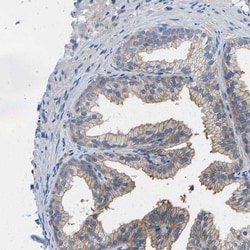 Invitrogen Calcineurin A Polyclonal Antibody 100 &mu;L; Unconjugated:Antibodies,