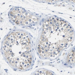 Invitrogen Calcineurin A Polyclonal Antibody 100 &mu;L; Unconjugated:Antibodies,