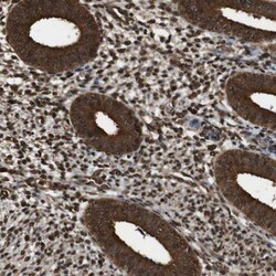 Invitrogen VCP Polyclonal Antibody 100 &mu;L | Buy Online | Invitrogen&trade; | Fisher Scientific