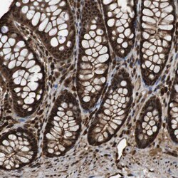 Invitrogen VCP Polyclonal Antibody 100 &mu;L | Buy Online | Invitrogen&trade; | Fisher Scientific