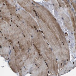 Invitrogen VCP Polyclonal Antibody 100 &mu;L | Buy Online | Invitrogen&trade; | Fisher Scientific