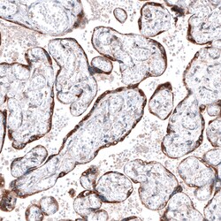 Invitrogen ROBO2 Polyclonal Antibody 100 &mu;L; Unconjugated:Antibodies,
