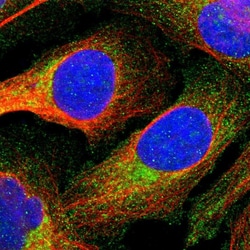 Invitrogen Annexin A3 Polyclonal Antibody 100 &mu;L; Unconjugated:Antibodies,