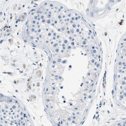 Invitrogen Annexin A3 Polyclonal Antibody 100 &mu;L; Unconjugated:Antibodies,